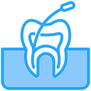 Root Canal Treatment