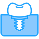 Dental Implant